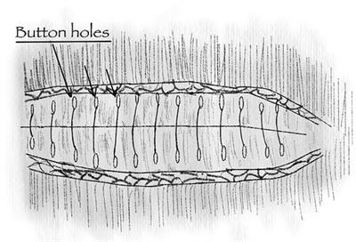 Don't fear the (small) bite: A narrative review of the rationale and misconceptions surrounding closure of abdominal wall incisions